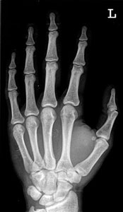 Exemple de radiographie
